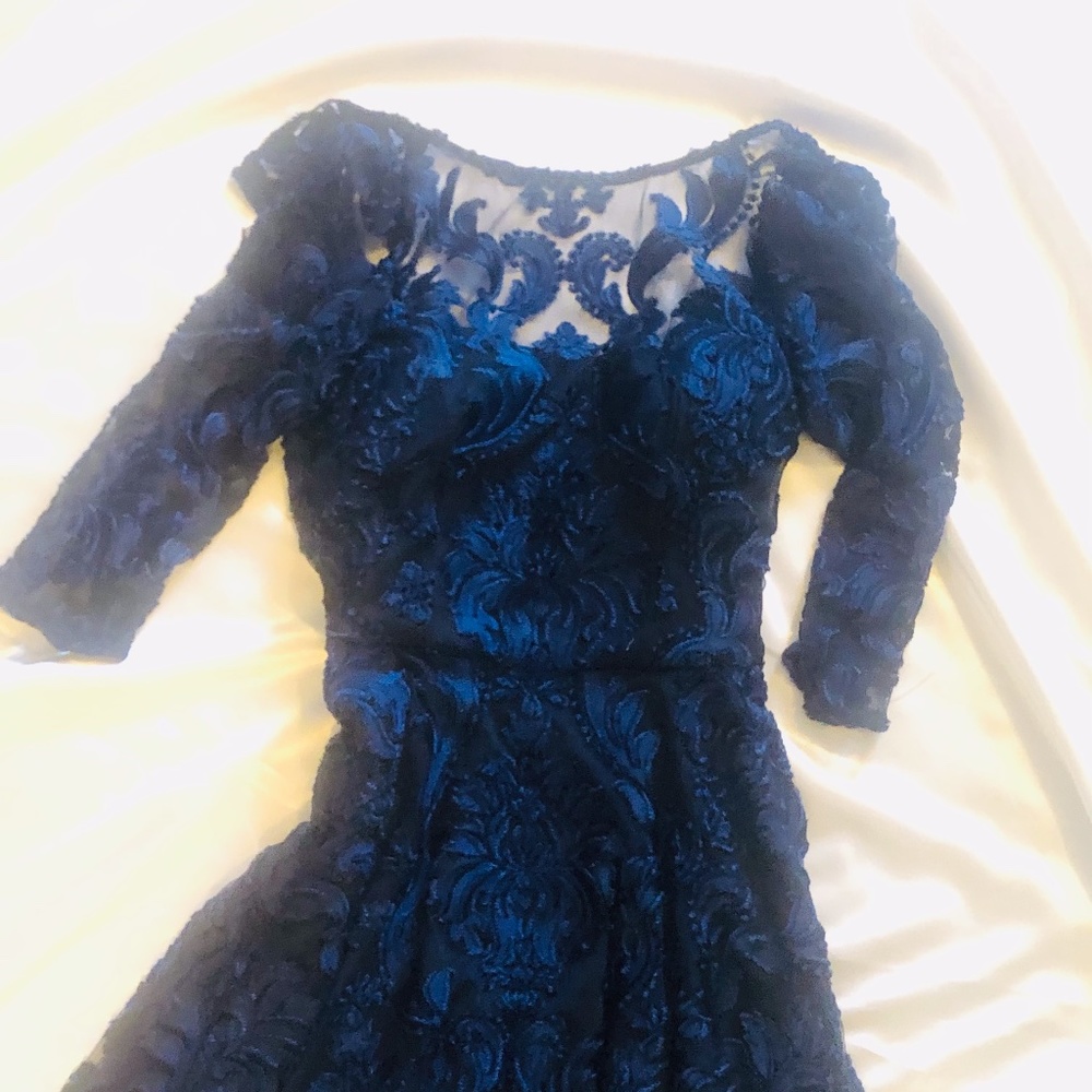 Lace dress.